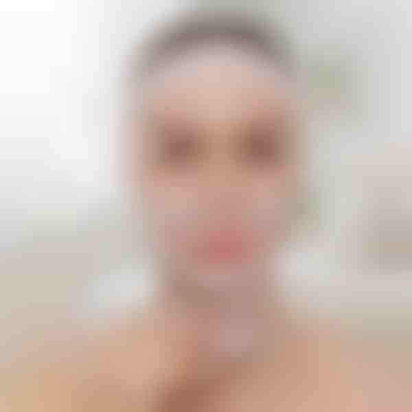 Povzdigovalni trak za oblikovanje obraza | KIMLIFT