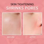 BLOOMSTICK-3831127521140